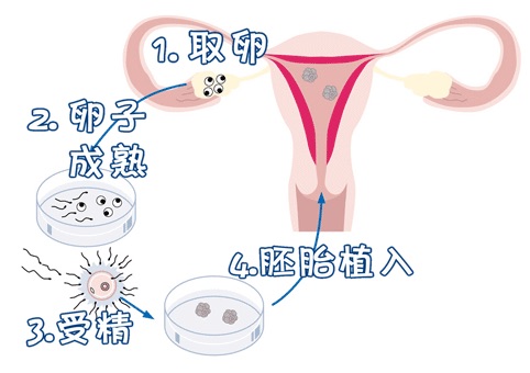 代怀选性别包生男孩代生医院生殖中心